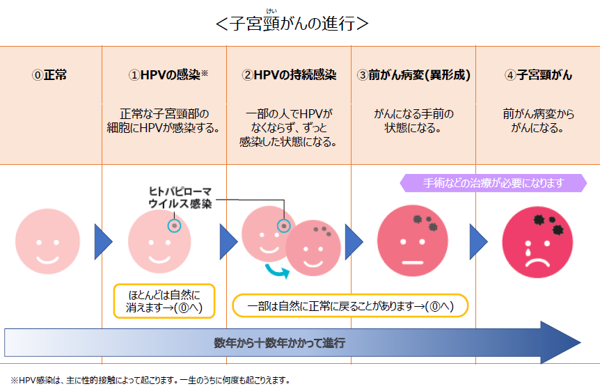 子宮頸がんの進行
